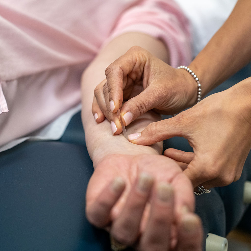 Acupuncture
