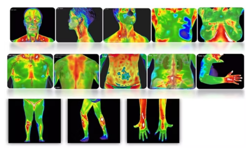 Types of Thermography Scan Images