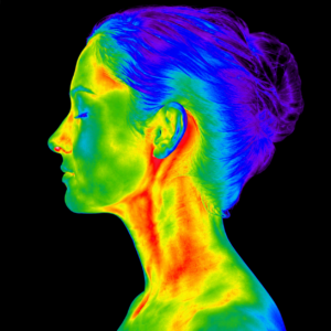 Thermography image of the head and neck showing variations in surface temperature and heat patterns.