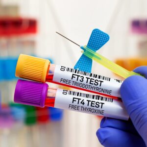 T3 and T4 thyroid blood test results used to assess thyroid hormone levels and thyroid function.