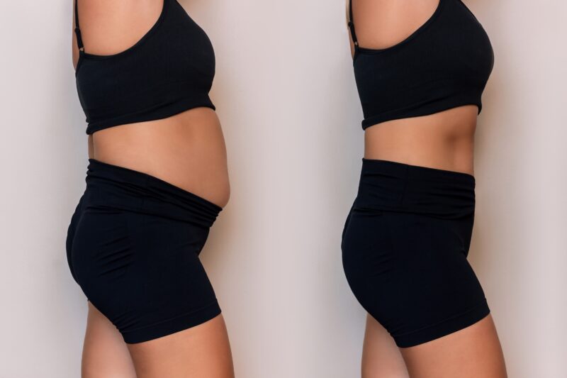Side-by-side image illustrating a change in abdominal body composition and belly fat.